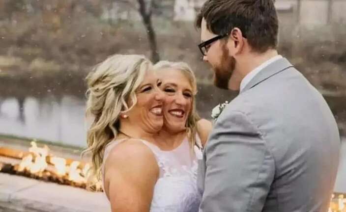 Сіамські близнючки Еббі та Бріттані Генсел, ймовірно, стали мамами