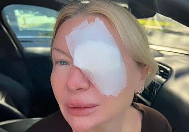 Два месяца ждала операции из-за ячменя: Украинка ощутила все "прелести" американской медицины