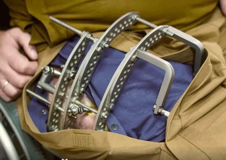 "Пакет раненого": Минобороны отчитывается о поставках адаптивной одежды в прифронтовые медучреждения