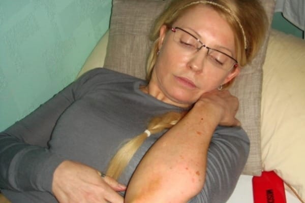 жуля-синяки dqxikeidqxiqqeant