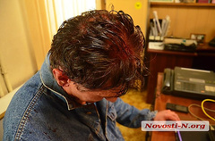 В Николаеве националисты и участники АТО подрались с «афганцами» - Copyright https://news.pn