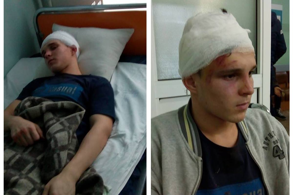 Руслана били ногами и битой по голове Руслана били ногами и битой по голове dqxikeidqxiqqeant