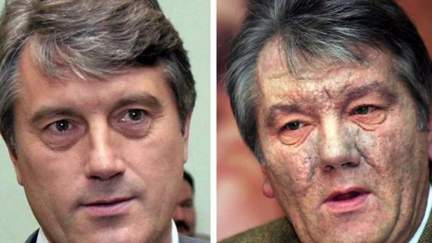 Ukraine’s former president Viktor Yushchenko dqxikeidqxitkant