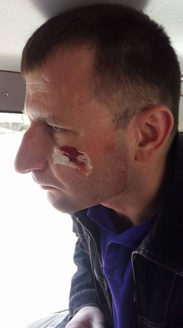 В Тернополе избили журналистов прямо во время расследования - 120853 В Тернополе избили журналистов прямо во время расследования - фото 120853 dqxikeidqxitkant