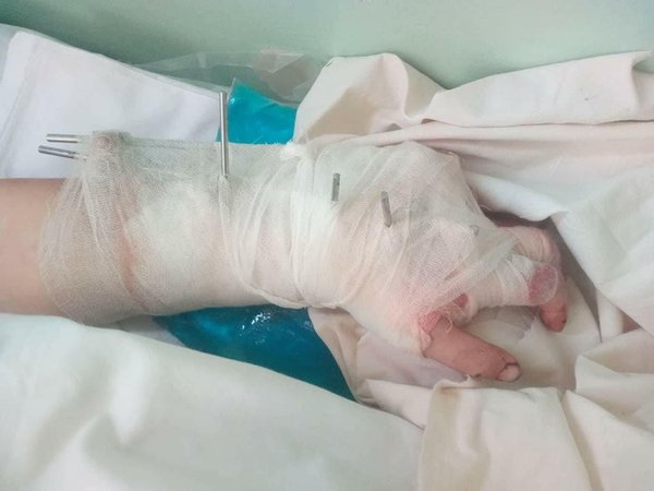 Ñобака, травма, покуÑала ÑобакÐ, проишеÑтвиÑ, киев, буча, Ñтаф