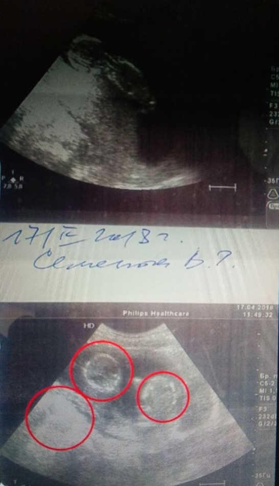 ÑодÑ, деÑи, ÑÑойнÑ, пÑеÑÑÑпление, dqxikeidqxiqqeant