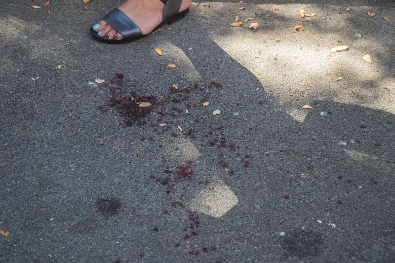 Ð•Ð¼Ñƒ Ð¾Ñ‚Ð¾Ñ€Ð²Ð°Ð»Ð¾ ÐºÐ¸ÑÑ‚ÑŒ Ñ€ÑƒÐºÐ¸ Ð¼ÑƒÑÐ¾Ñ€Ð¾Ð²Ð¾Ð·Ð¾Ð¼