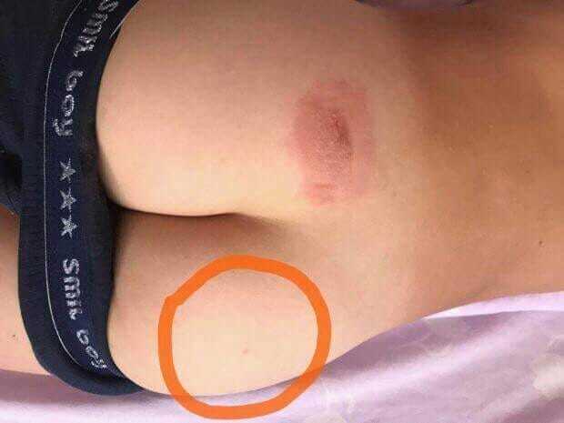   咒:   钒      dqxikeidqxitkant