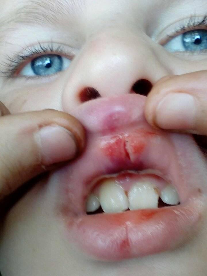 На Прикарпатье ребенка погибшего АТОшника избили за казачий чуб dqxikeidqxiqqeant