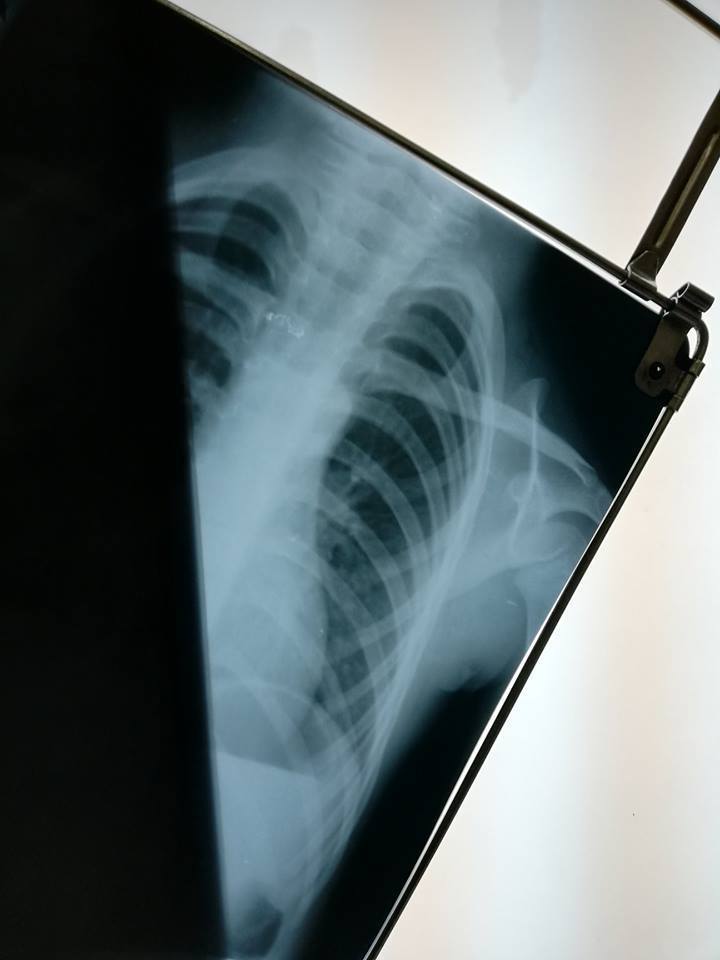    :         dqxikeidqxiqqeant