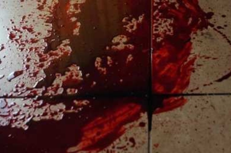 ÐÑÑа ÑкÑаинÑкого гоÑода облили кÑовÑÑ Ð·Ð° ÑÐµÐ±ÐµÐ½ÐºÑ Ð´Ð»Ñ ÐÑÑмÑкого моÑÑа