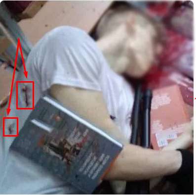 ÐеÑÑвÑй РоÑлÑков и пÑлевÑе оÑмеÑÐ¸Ð½Ñ Ð½Ð° Ð±Ð¾ÐºÑ Ð¸ Ñпине dqxikeidqxitkant