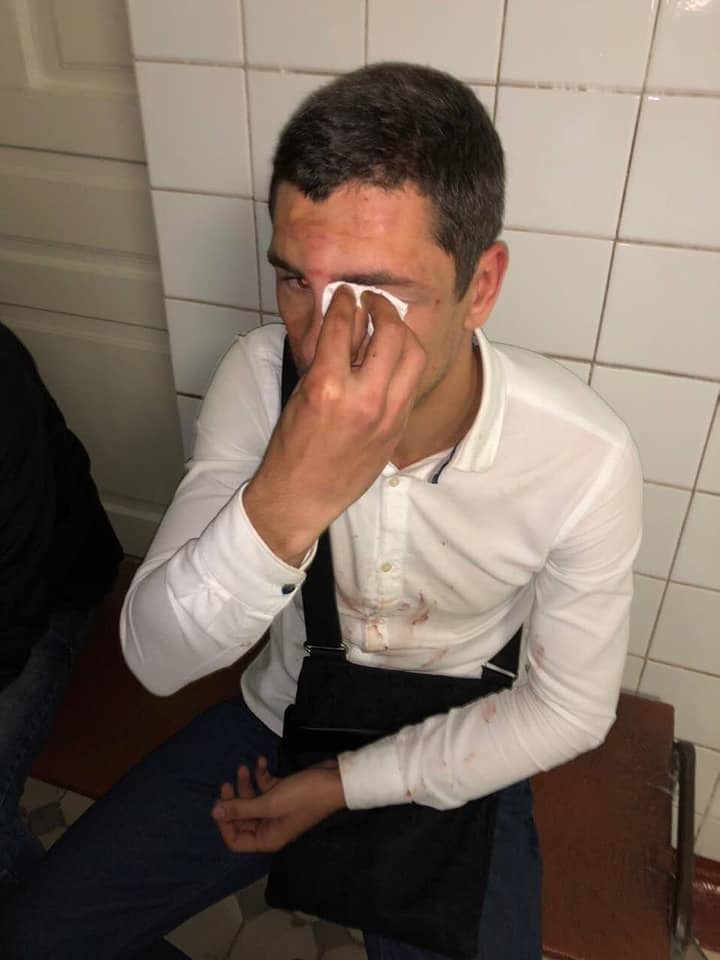 ’’ÐоÑледнее пÑедÑпÑеждение’’: в Ðиеве жеÑÑоко избили ÑоÑаÑника ÐÑÑко