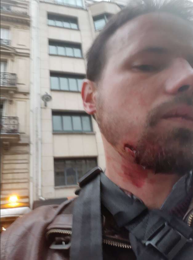 ТопливнÑй ’’Ðайдан’’: в ÐаÑиже подÑÑÑелили пÑопагандиÑÑа ÐÑÐµÐ¼Ð»Ñ dqxikeidqxiqqeant