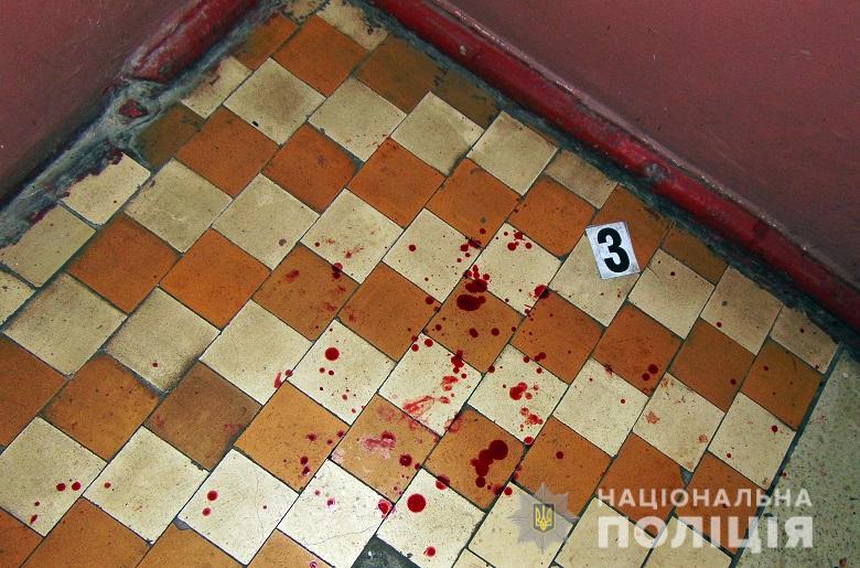 Родном из Ñ
оÑÑелов на ÑлиÑе ÐлмаÑинÑкой мÑжÑина ÑдаÑил в гÑÑÐ´Ñ Ð½Ð¾Ð¶Ð¾Ð¼ поÑÑоÑлÑÑа dqxikeidqxiqqeant