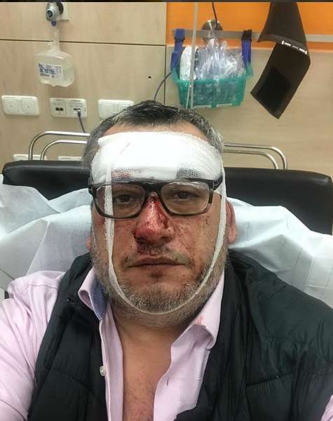 ’’Так ÑделаÑÑ Ð²Ð¾ вÑем миÑе’’: ÑоÑÑийÑкого пÑопагандиÑÑа вÑÑвÑÑнÑли из болÑниÑÑ Ð² ÐеÑмании dqxikeidqxiqqeant