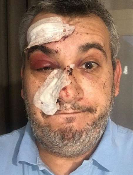 ’’Так сделают во всем мире’’: российского пропагандиста вышвырнули из больницы в Германии