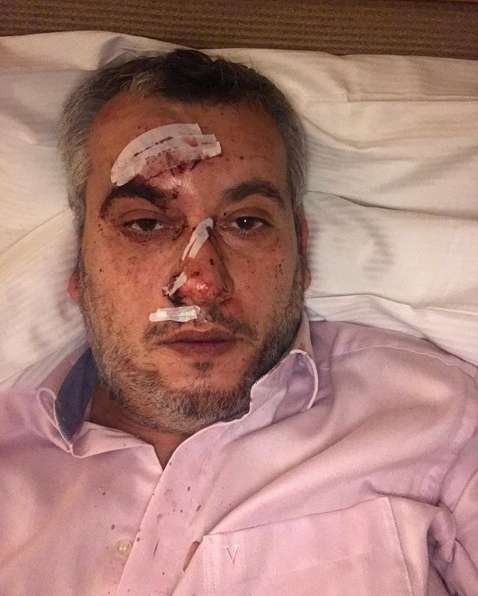 ’’Так сделают во всем мире’’: российского пропагандиста вышвырнули из больницы в Германии