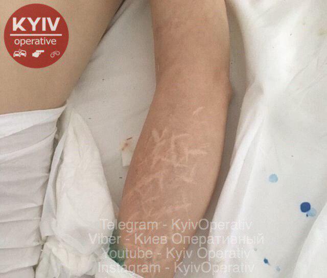 Ð ÑÑ
нÑла Ñ Ð²ÑÑоÑÑ: в Ðиеве наÑли иÑкалеÑеннÑÑ Ð¶ÐµÐ½ÑÐ¸Ð½Ñ Ñ ÑаÑÑиÑовкой