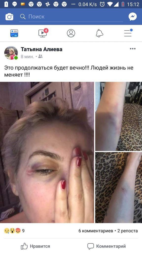 СкандалÑнÑй ÑкÑ-Ð´Ð¸Ð½Ð°Ð¼Ð¾Ð²ÐµÑ Ðлиев избил ÑÐ²Ð¾Ñ Ð±ÑвÑÑÑ Ð¶ÐµÐ½Ñ