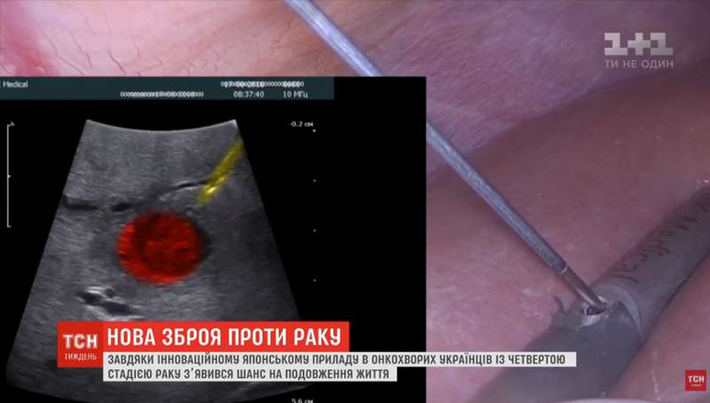     :       dqxikeidqxitkant