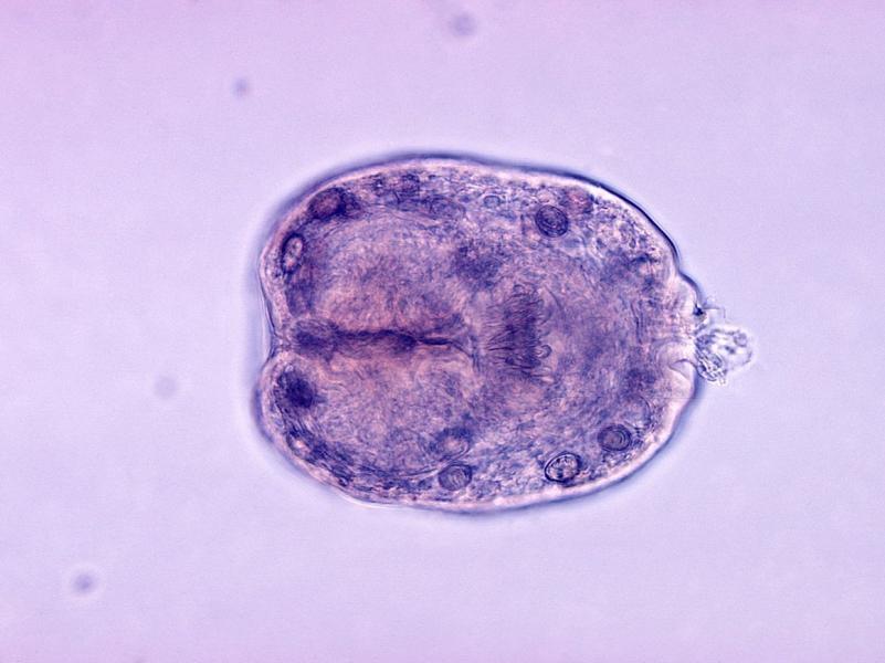 Гистологический препарат Echinococcus granulosus dqxikeidqxitkant
