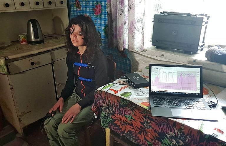 Мачеха побитого ребенка dqxikeidqxiqqeant