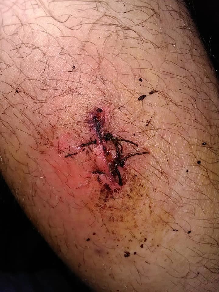 Новая бойня соседей: в многоэтажке Киева с ножом напали на семью dqxikeidqxiqqeant