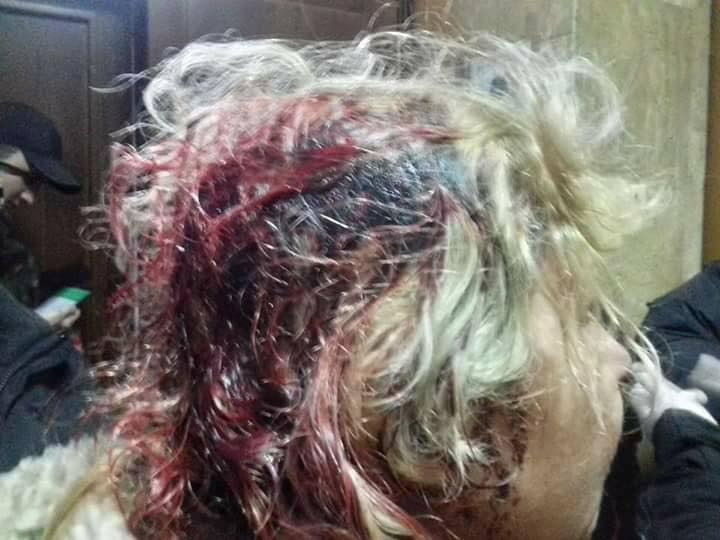 На данном изображении может находиться: один или несколько человек и часть тела крупным планом