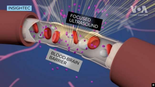 -    dqxikeidqxiqqeant