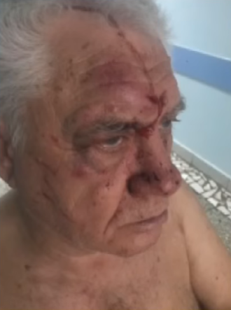 "Что ты, с*ка, цепляешься ко мне?!" Как полицейский избил пенсионера в Харькове, фото