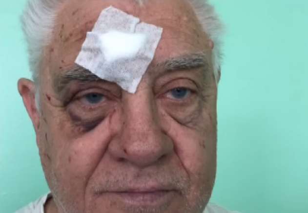 "Что ты, с*ка, цепляешься ко мне?!" Как полицейский избил пенсионера в Харькове, фото