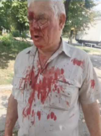 "Что ты, с*ка, цепляешься ко мне?!" Как полицейский избил пенсионера в Харькове, фото