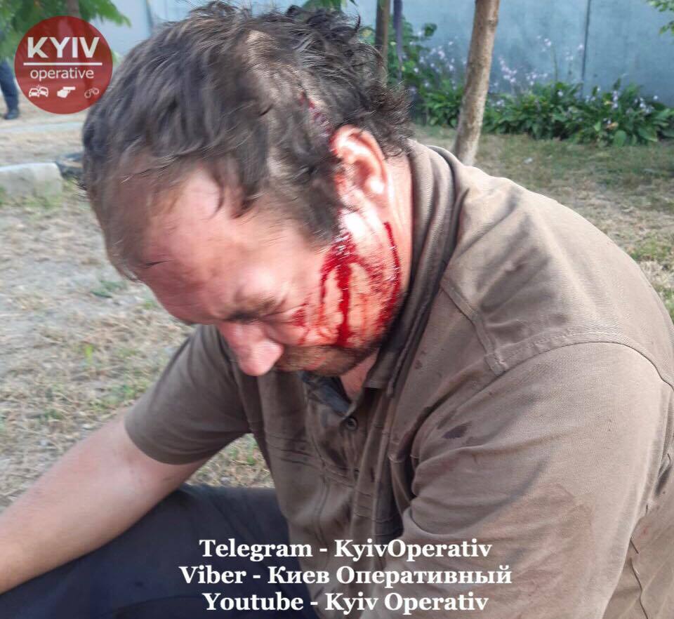       :  18+ dqxikeidqxiqqeant