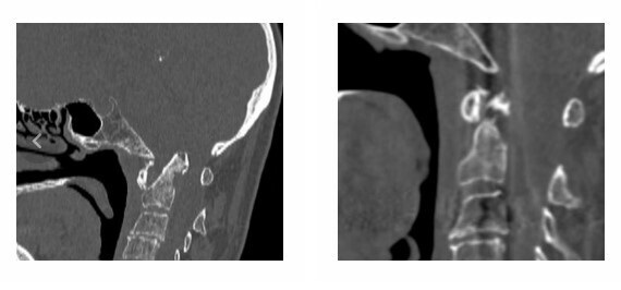  ,     dqxikeidqxiqqeant