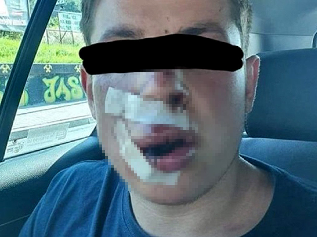 base article image dqxikeidqxitkant