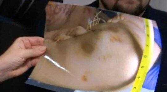 Родители привели доказательства убийства 14-летнего подростка из Прилук dqxikeidqxiqqeant