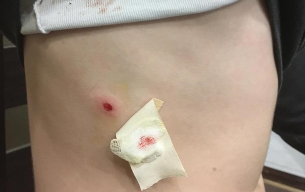 В Николаеве школьник выстрелил в одноклассника dqxikeidqxiqqeant