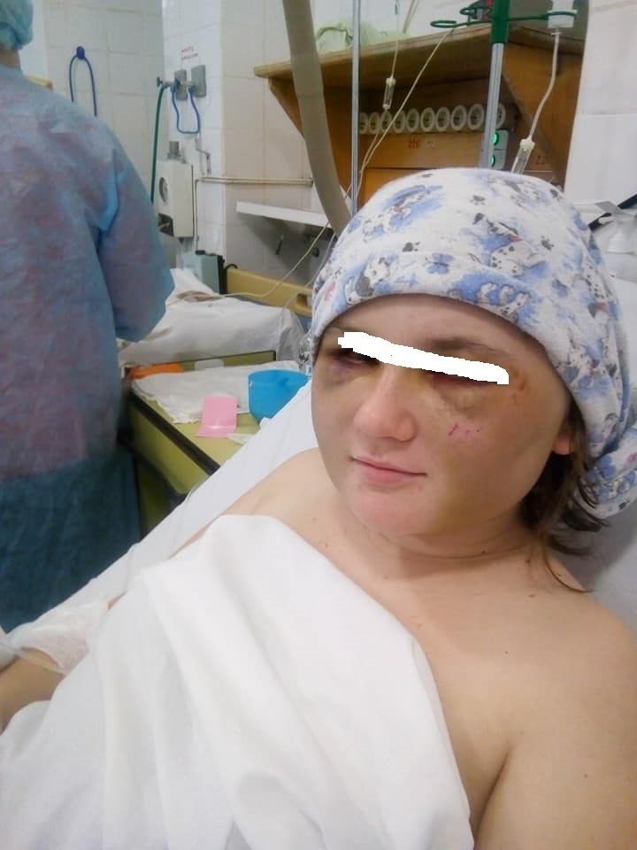 В Херсоне парень зверски избил экс-возлюбленную: девушка в реанимации. Фото dqxikeidqxitkant