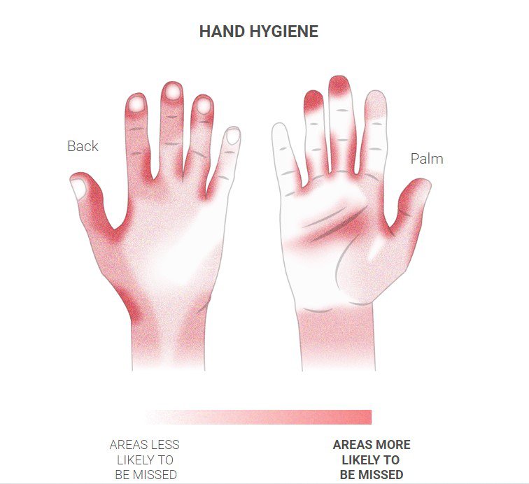 Чим червоніший колір на інфографіці – тим більша ймовірність пропустити цю частину рук при митті dqxikeidqxiqqeant