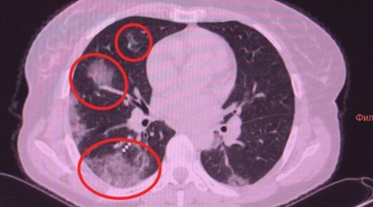 ,   dqxikeidqxitkant