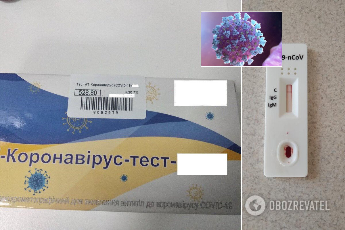 Украинские аптеки заполонили экспресс-тесты на COVID-19: почему это – деньги на ветер dqxikeidqxitkant