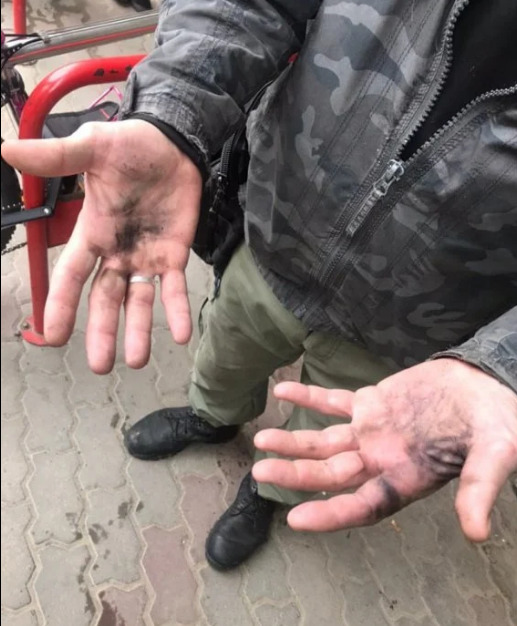 У вÑддÑÐ»ÐµÐ½Ð½Ñ ÐÐ¾Ð²Ð¾Ñ Ð¿Ð¾ÑÑи Ñ ÐÑÐ²Ð¾Ð²Ñ Ð·Ð´ÐµÑонÑвала навÑалÑна гÑанаÑа Ð ÐÐ-5, надÑÑлана в поÑилÑÑ 02 dqxikeidqxiqqeant