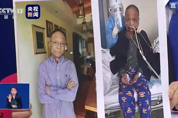 Появились новые фото врача из Китая, который "почернел" от коронавируса