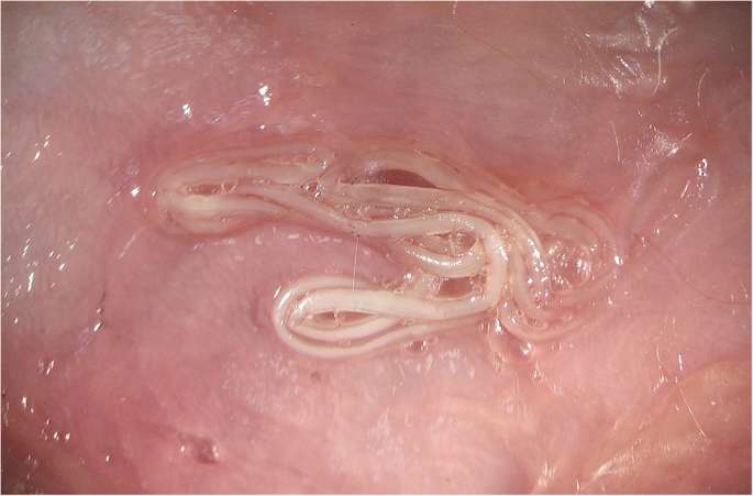 Dirofilaria repens dqxikeidqxitkant