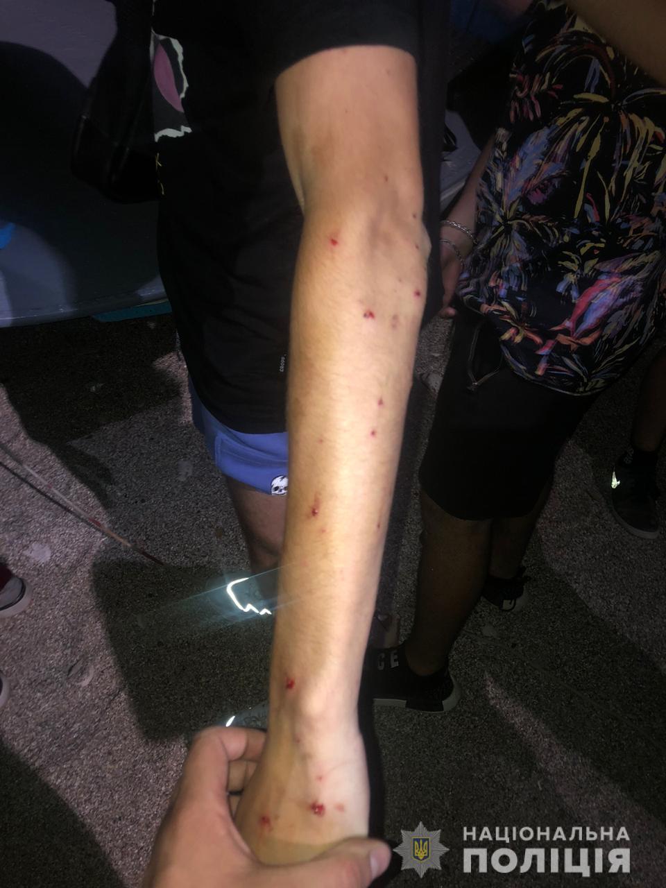 В Одессе дачник расстрелял компанию молодежи, которая собралась отметить день рождения. Фото: Нацполиция dqxikeidqxiqqeant