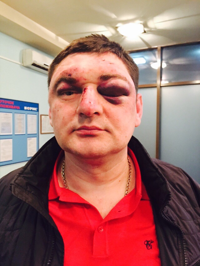 ^FC64A31E193F92C97315BA5DA4CA9944155EB20166B57EF2E5^pimgpsh_fullsize_distr dqxikeidqxitkant