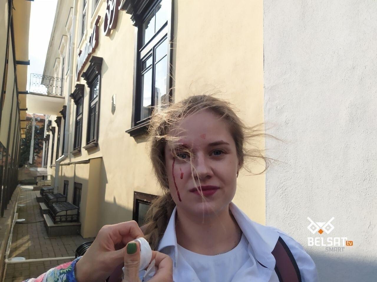 Силовик ударил девушку в лицо dqxikeidqxitkant