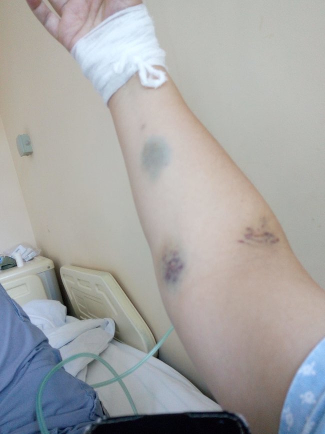 Як лікують коронавірус у державній лікарні в Києві. Особистий досвід 07 Як лікують коронавірус у державній лікарні в Києві. Особистий досвід 07