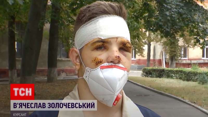 У Вячеслава врачи диагностировали сотрясение головного мозга, ушибы и ожоги. dqxikeidqxitkant